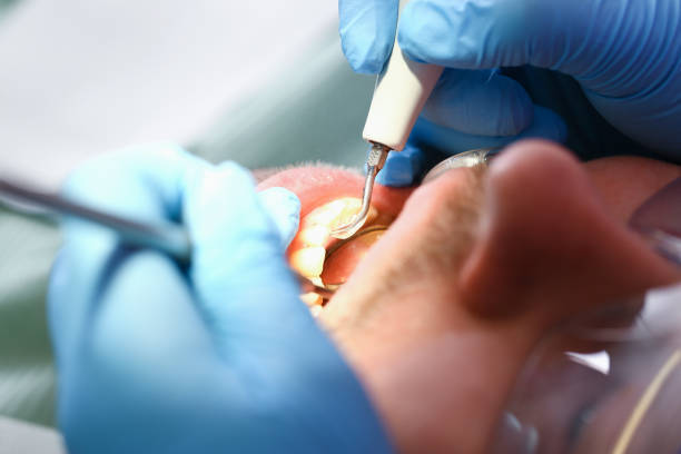 Best Holiday Emergency Dentist in Grove City, FL